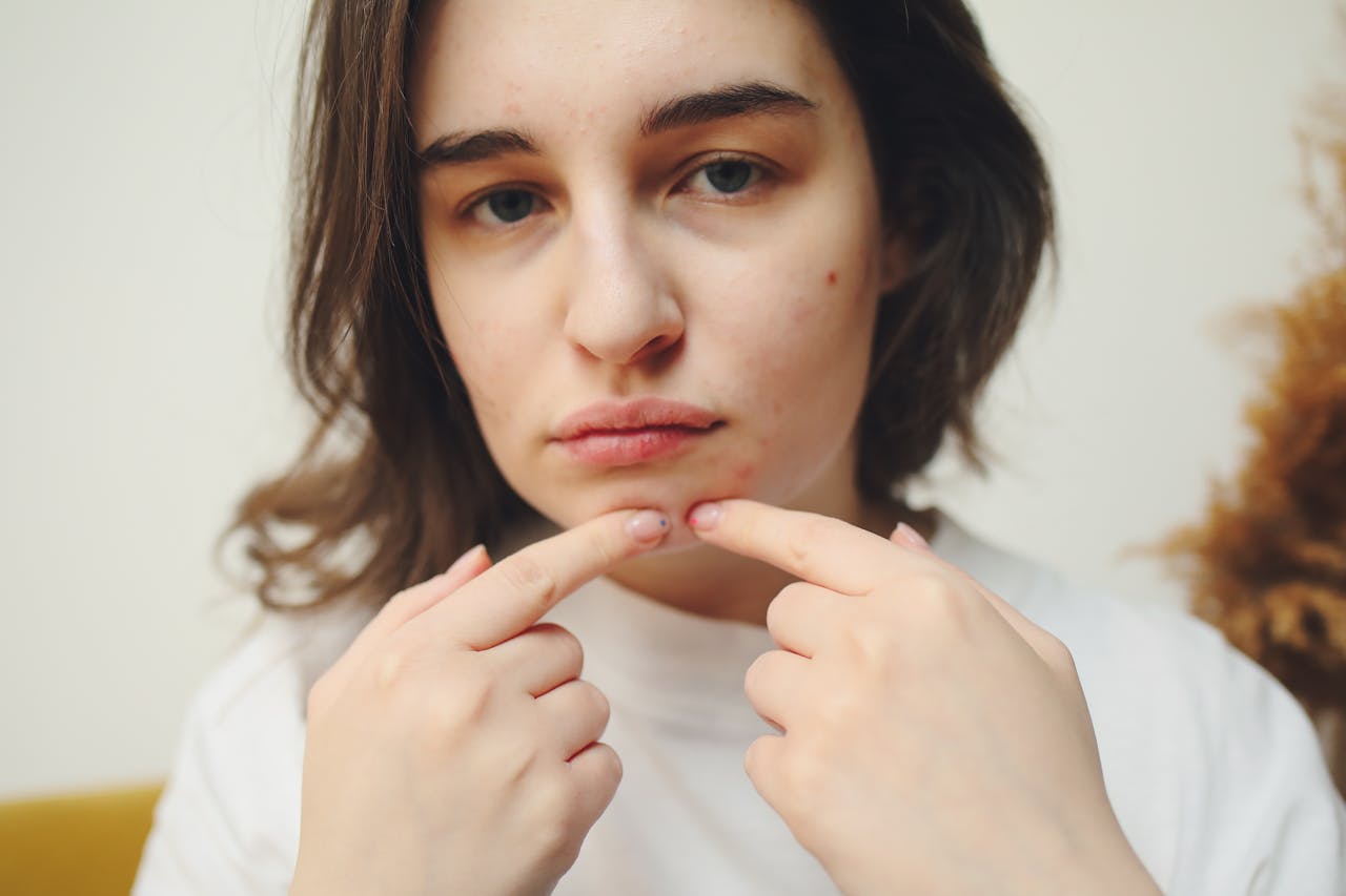 Lire la suite à propos de l’article Comment enlever un bouton sur le visage en une nuit ?